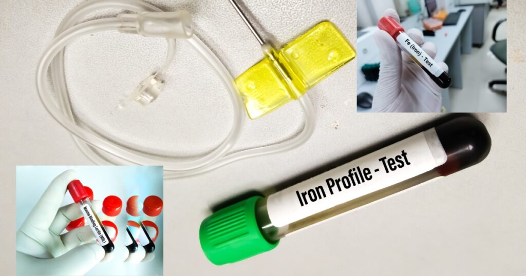 Diagnostic Insights: Tests for Assessing Iron Saturation Levels
