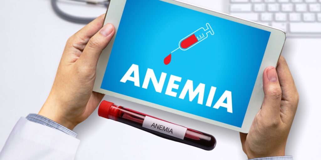 How to Diagnose Anemia